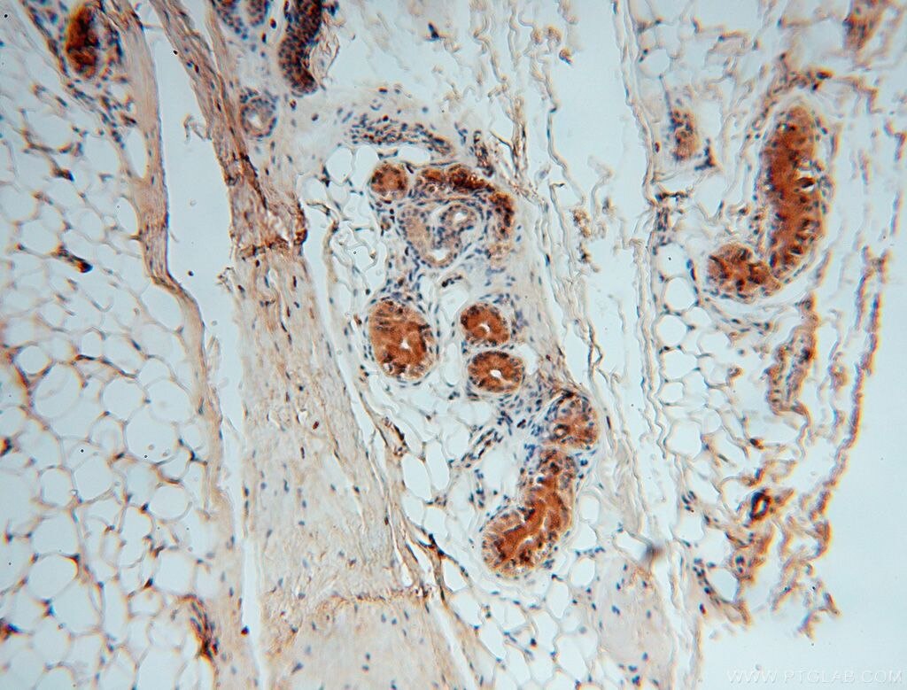 Immunohistochemistry (IHC) staining of human skin tissue using P3H2 Polyclonal antibody (15723-1-AP)