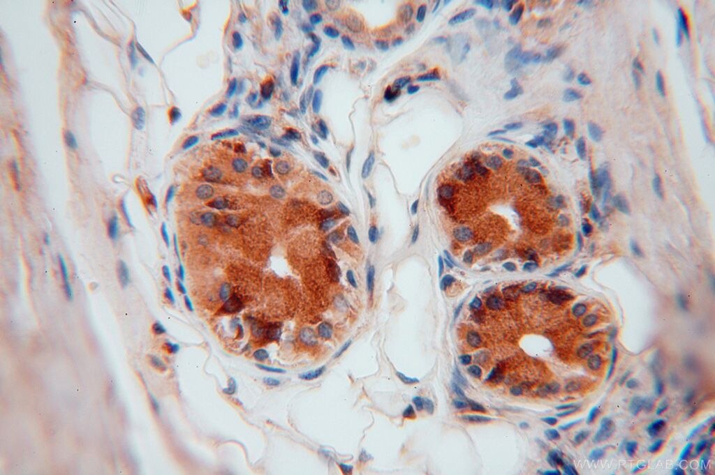 Immunohistochemistry (IHC) staining of human skin tissue using P3H2 Polyclonal antibody (15723-1-AP)