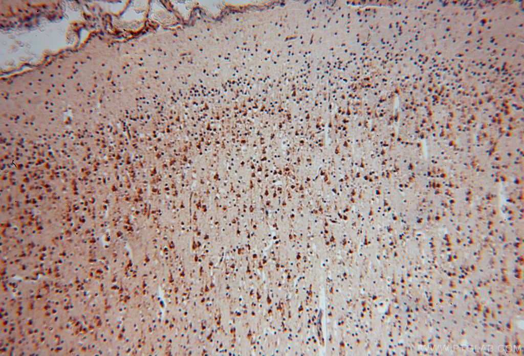 Immunohistochemistry (IHC) staining of human brain tissue using P3H2 Polyclonal antibody (15723-1-AP)