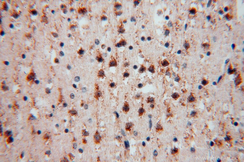 Immunohistochemistry (IHC) staining of human brain tissue using P3H2 Polyclonal antibody (15723-1-AP)