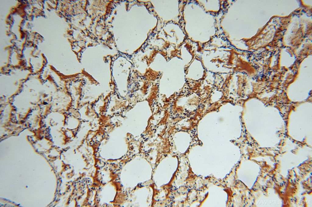 Immunohistochemistry (IHC) staining of human lung tissue using P3H2 Polyclonal antibody (15723-1-AP)