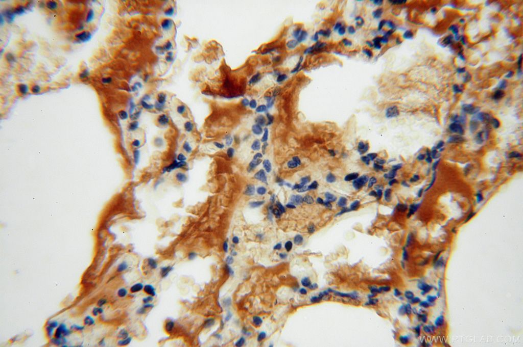 Immunohistochemistry (IHC) staining of human lung tissue using P3H2 Polyclonal antibody (15723-1-AP)