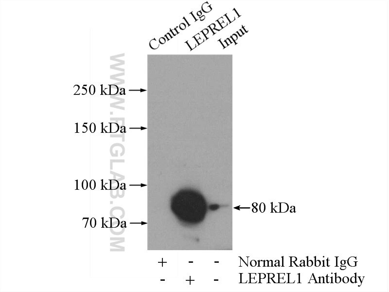 Immunoprecipitation (IP) experiment of mouse kidney tissue using P3H2 Polyclonal antibody (15723-1-AP)