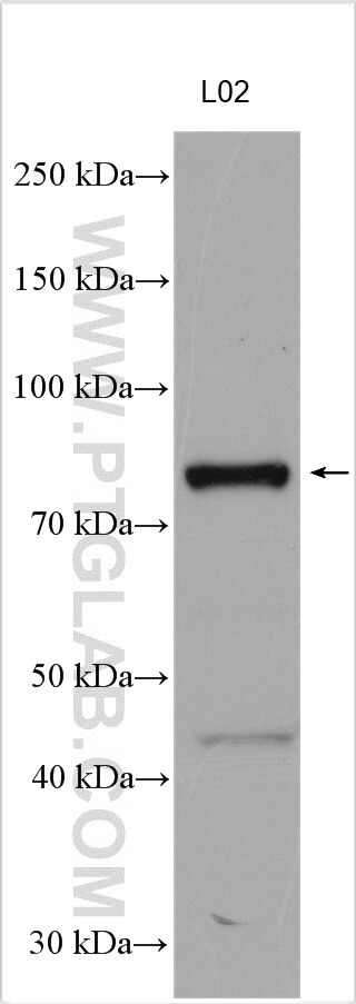 Western Blot (WB) analysis of various lysates using P3H2 Polyclonal antibody (15723-1-AP)