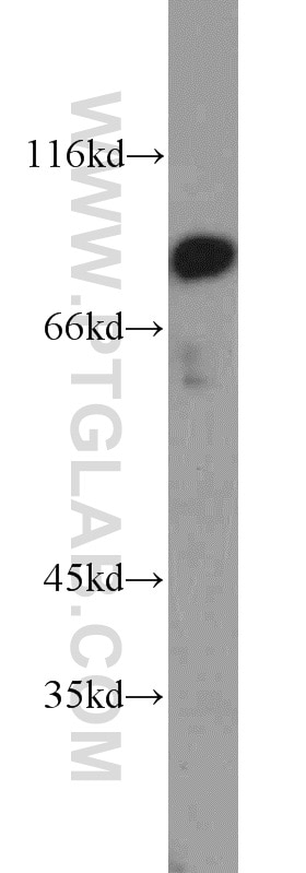 Western Blot (WB) analysis of mouse placenta tissue using P3H2 Polyclonal antibody (15723-1-AP)