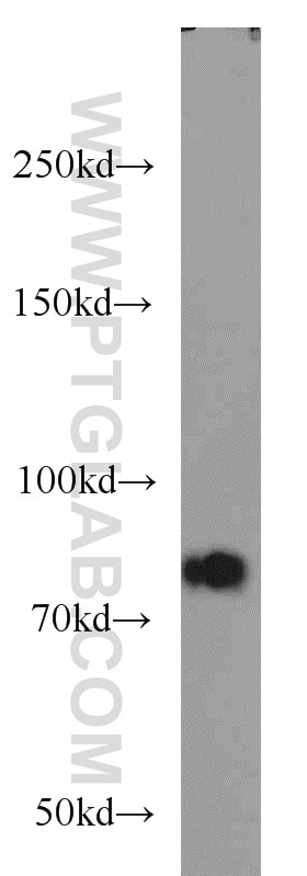 Western Blot (WB) analysis of mouse kidney tissue using P3H2 Polyclonal antibody (15723-1-AP)
