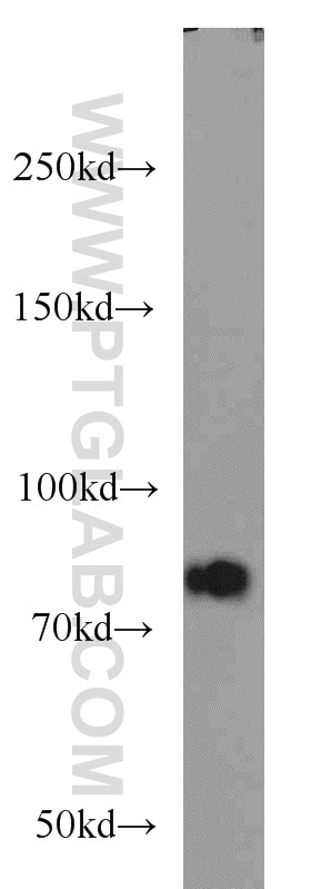 P3H2 Polyclonal antibody