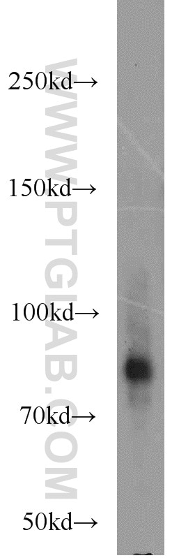 Western Blot (WB) analysis of human placenta tissue using P3H2 Polyclonal antibody (15723-1-AP)