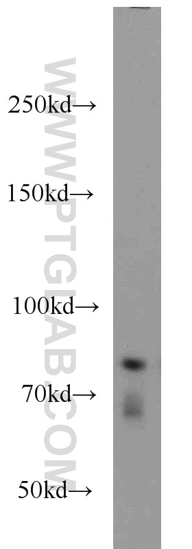 Western Blot (WB) analysis of HEK-293 cells using P3H2 Polyclonal antibody (15723-1-AP)