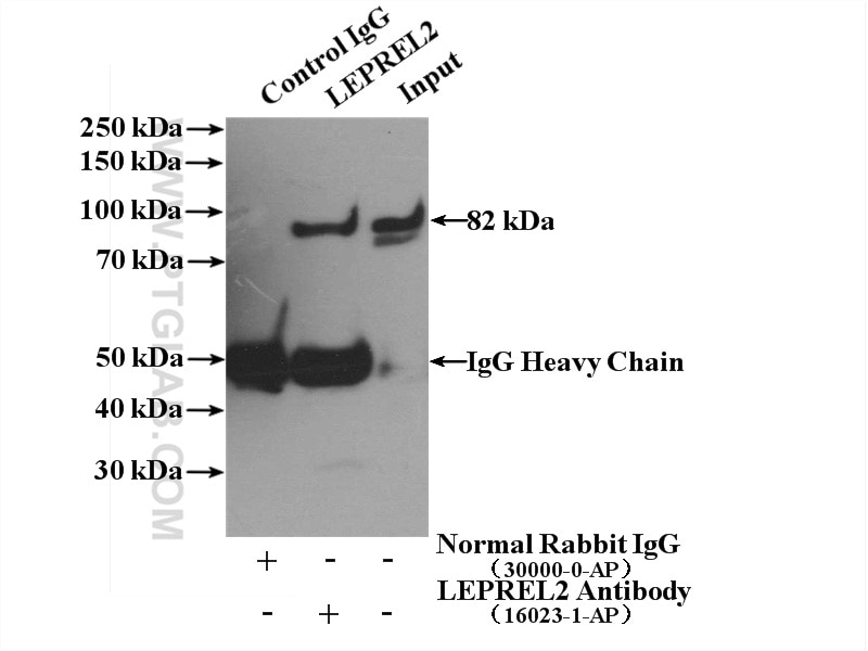 Immunoprecipitation (IP) experiment of MDA-MB-453s cells using P3H3 Polyclonal antibody (16023-1-AP)