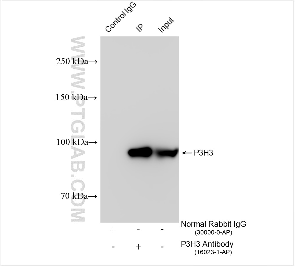 Immunoprecipitation (IP) experiment of MDA-MB-453 cells using P3H3 Polyclonal antibody (16023-1-AP)