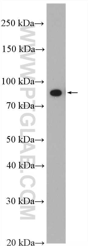 Western Blot (WB) analysis of MDA-MB-453s cells using P3H3 Polyclonal antibody (16023-1-AP)