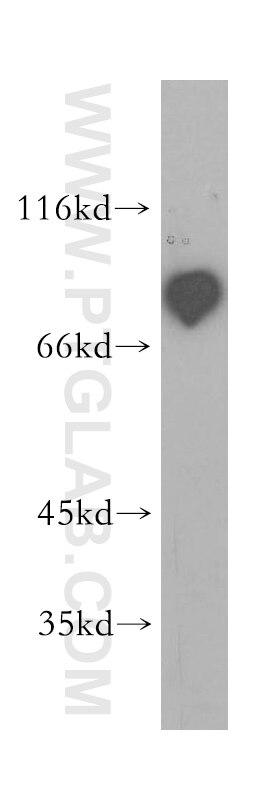 P3H3 Polyclonal antibody