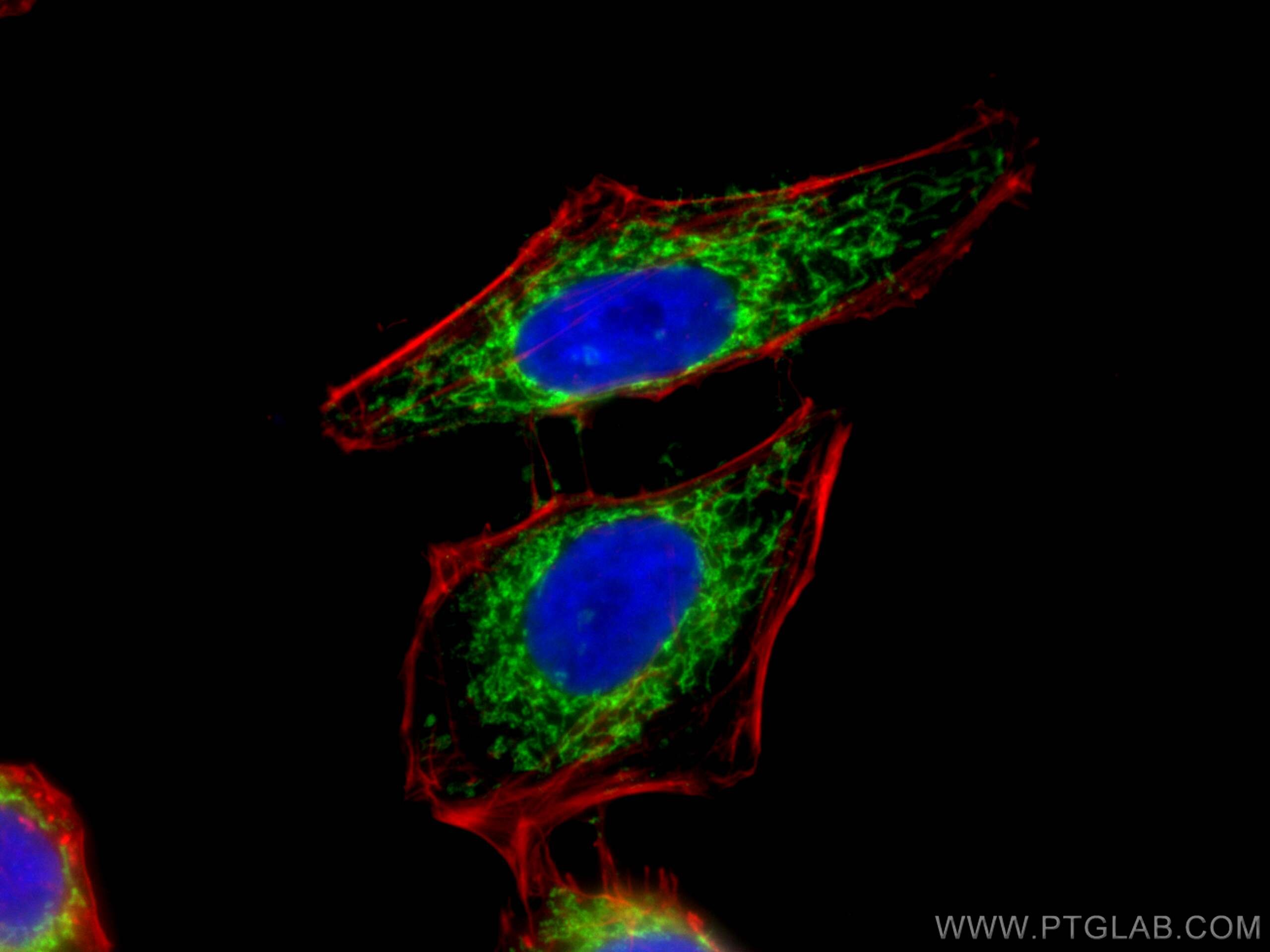 Immunofluorescence (IF) / fluorescent staining of HeLa cells using LETM1 Polyclonal antibody (16024-1-AP)