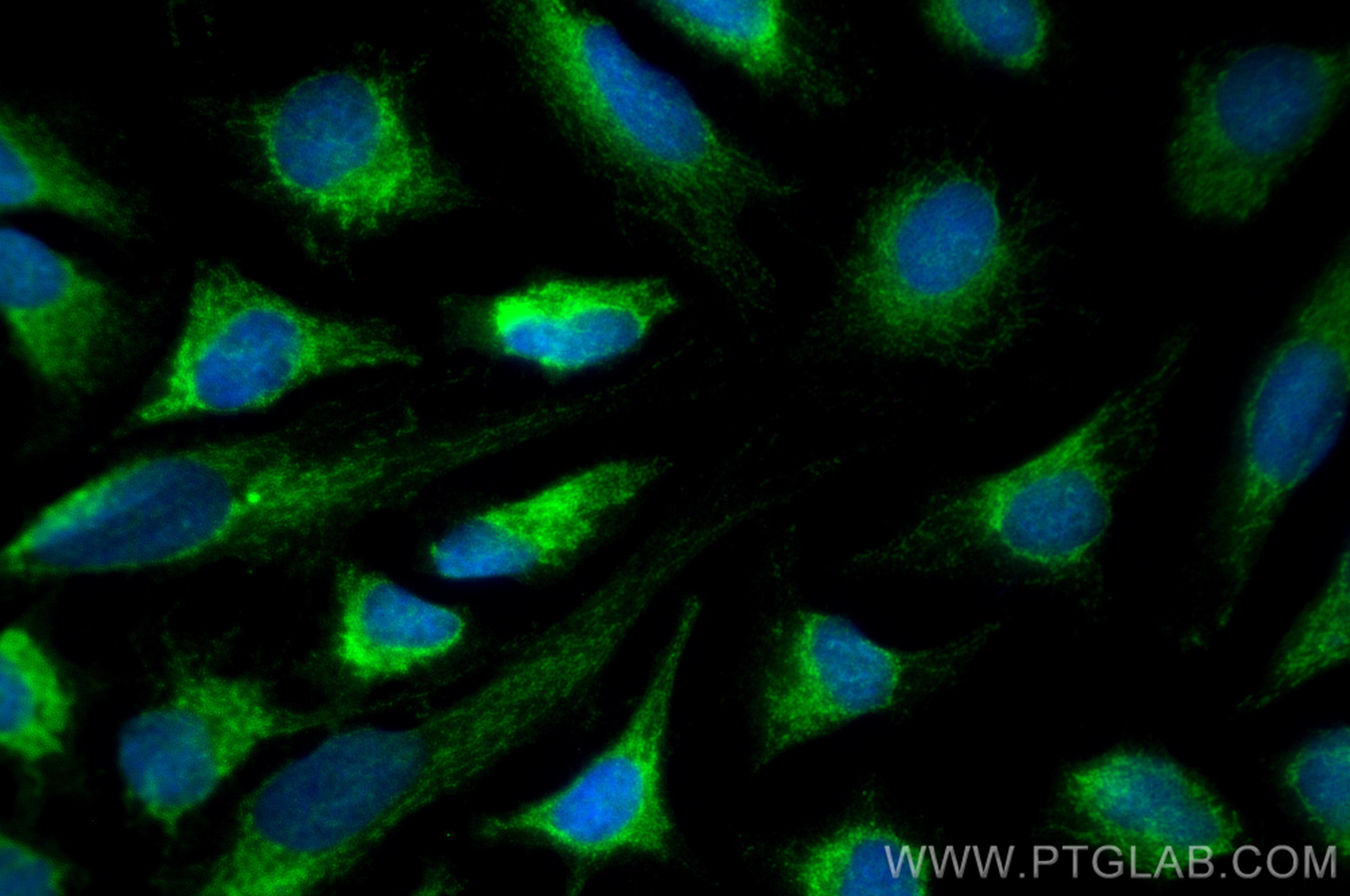 IF Staining of HeLa using 16024-1-AP