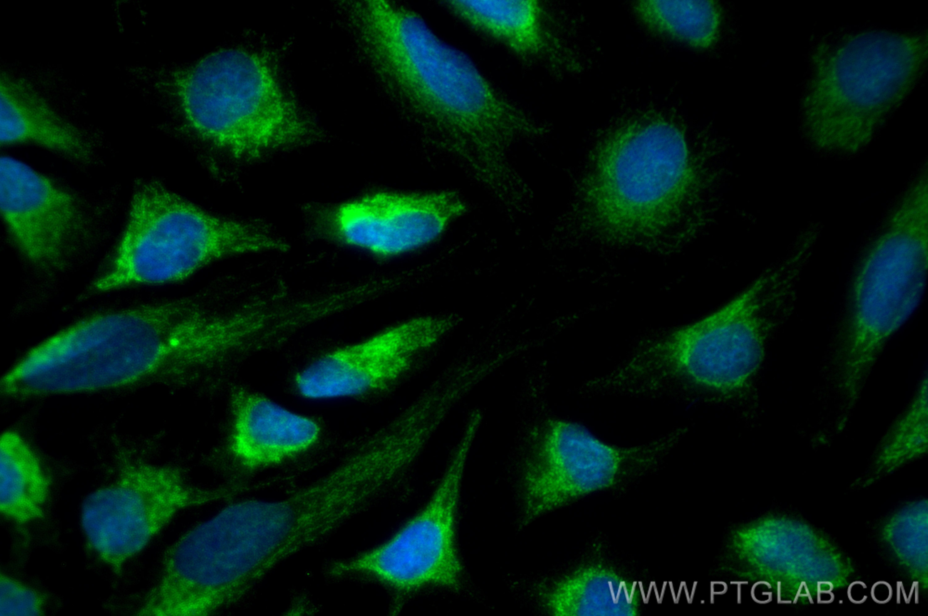 Immunofluorescence (IF) / fluorescent staining of HeLa cells using LETM1 Polyclonal antibody (16024-1-AP)