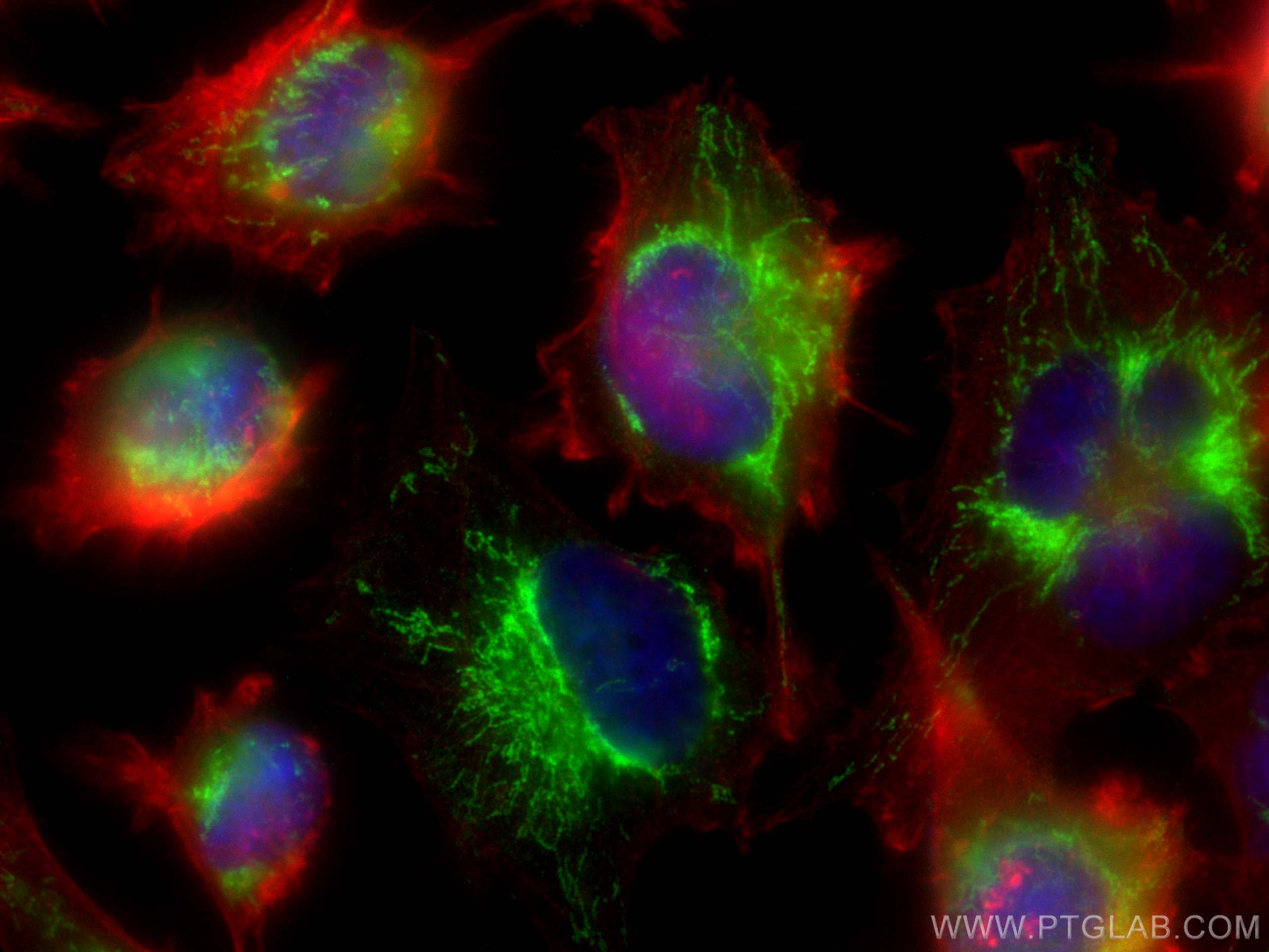 Immunofluorescence (IF) / fluorescent staining of U-251 cells using LETM1 Monoclonal antibody (68208-1-Ig)