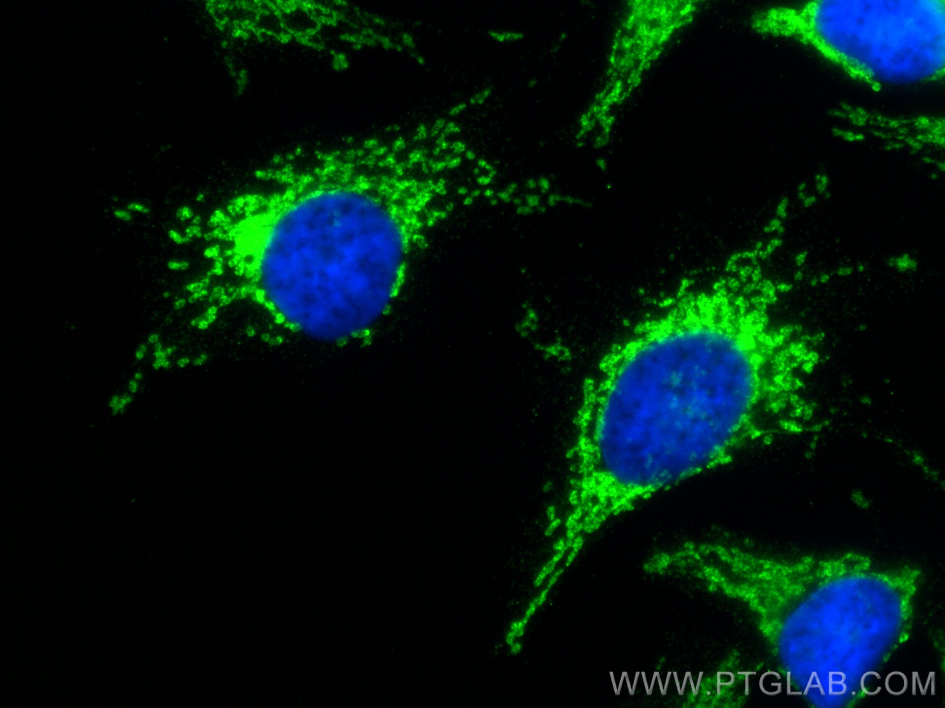 Immunofluorescence (IF) / fluorescent staining of HeLa cells using LETM1 Monoclonal antibody (68208-1-Ig)