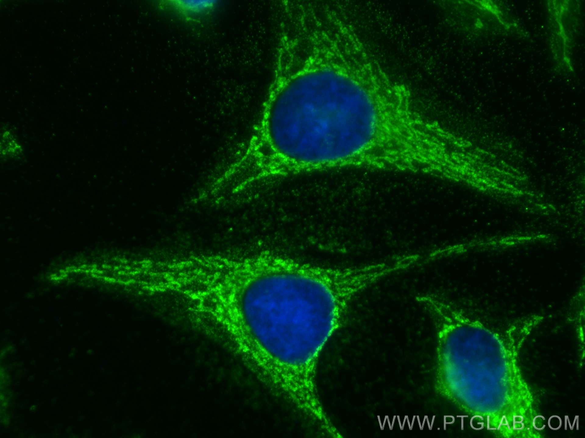 Immunofluorescence (IF) / fluorescent staining of HeLa cells using LETM1 Monoclonal antibody (68208-1-Ig)