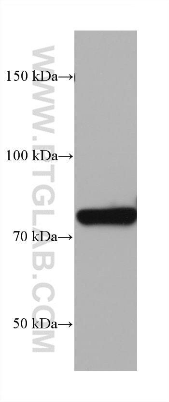 Western Blot (WB) analysis of rat heart tissue using LETM1 Monoclonal antibody (68208-1-Ig)