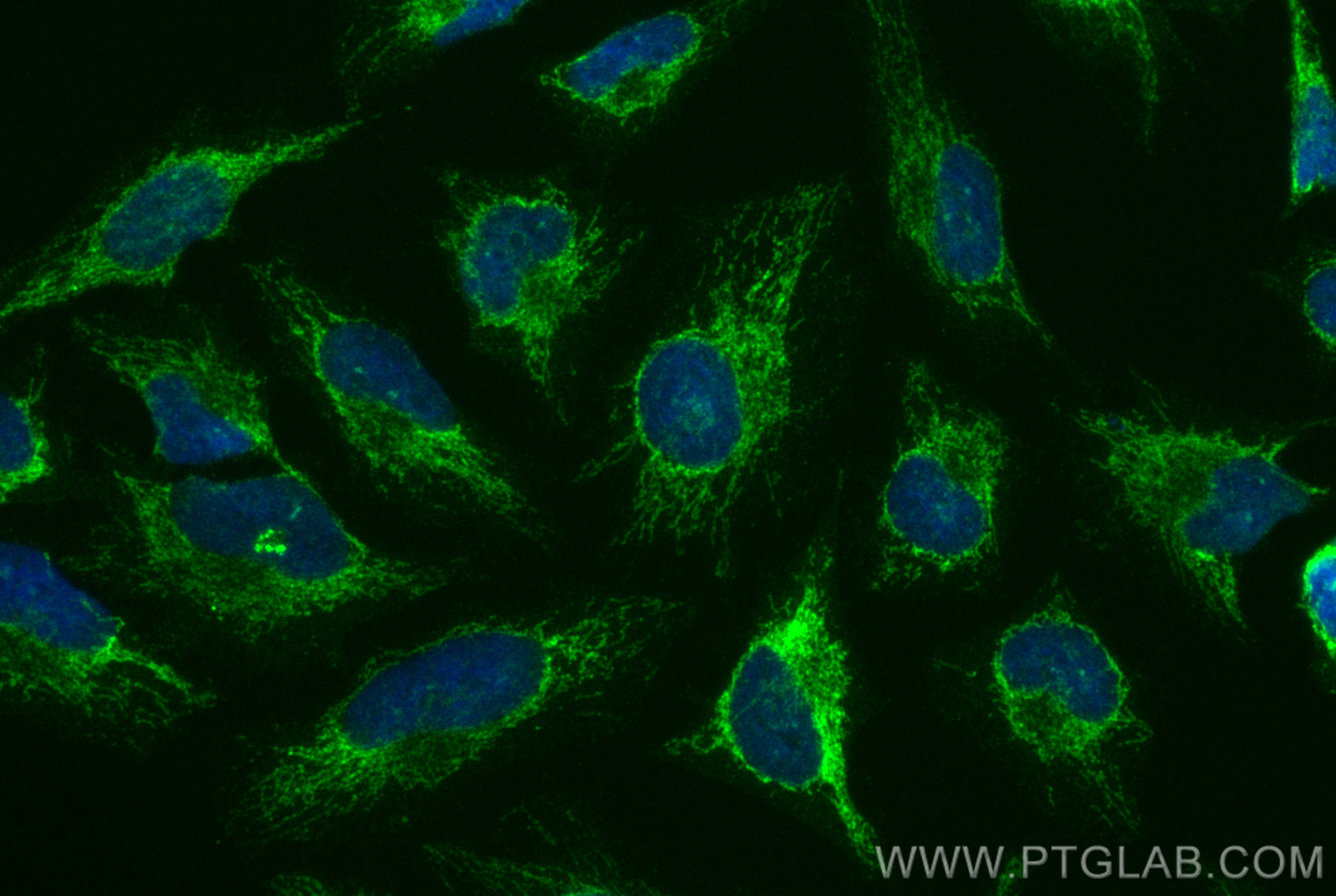 Immunofluorescence (IF) / fluorescent staining of HeLa cells using CoraLite® Plus 488-conjugated LETM1 Polyclonal ant (CL488-16024)