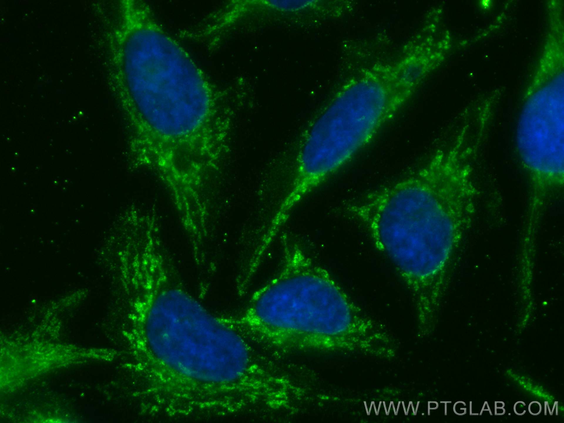 Immunofluorescence (IF) / fluorescent staining of HeLa cells using CoraLite® Plus 488-conjugated LETM1 Monoclonal ant (CL488-68208)