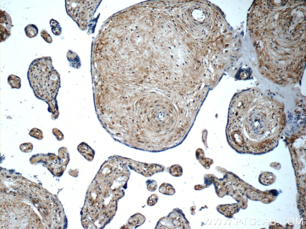 IHC staining of human placenta using 17180-1-AP
