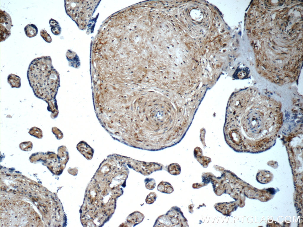 Immunohistochemistry (IHC) staining of human placenta tissue using LETM2 Polyclonal antibody (17180-1-AP)