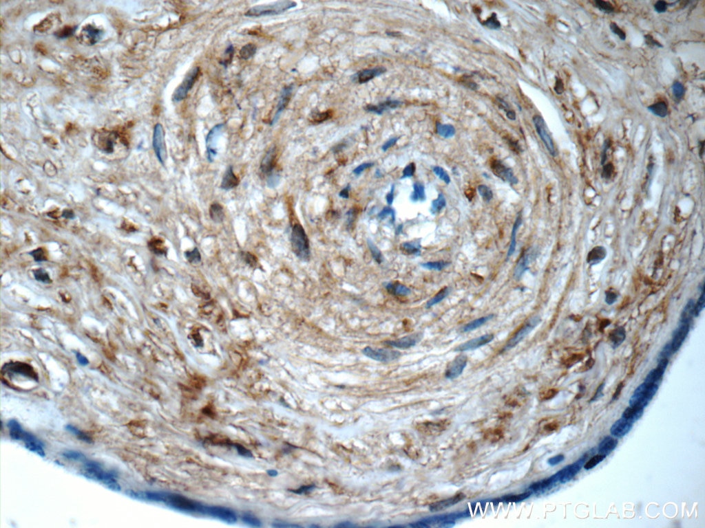 Immunohistochemistry (IHC) staining of human placenta tissue using LETM2 Polyclonal antibody (17180-1-AP)