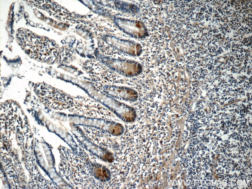 Immunohistochemistry (IHC) staining of human small intestine tissue using LETM2 Polyclonal antibody (17180-1-AP)