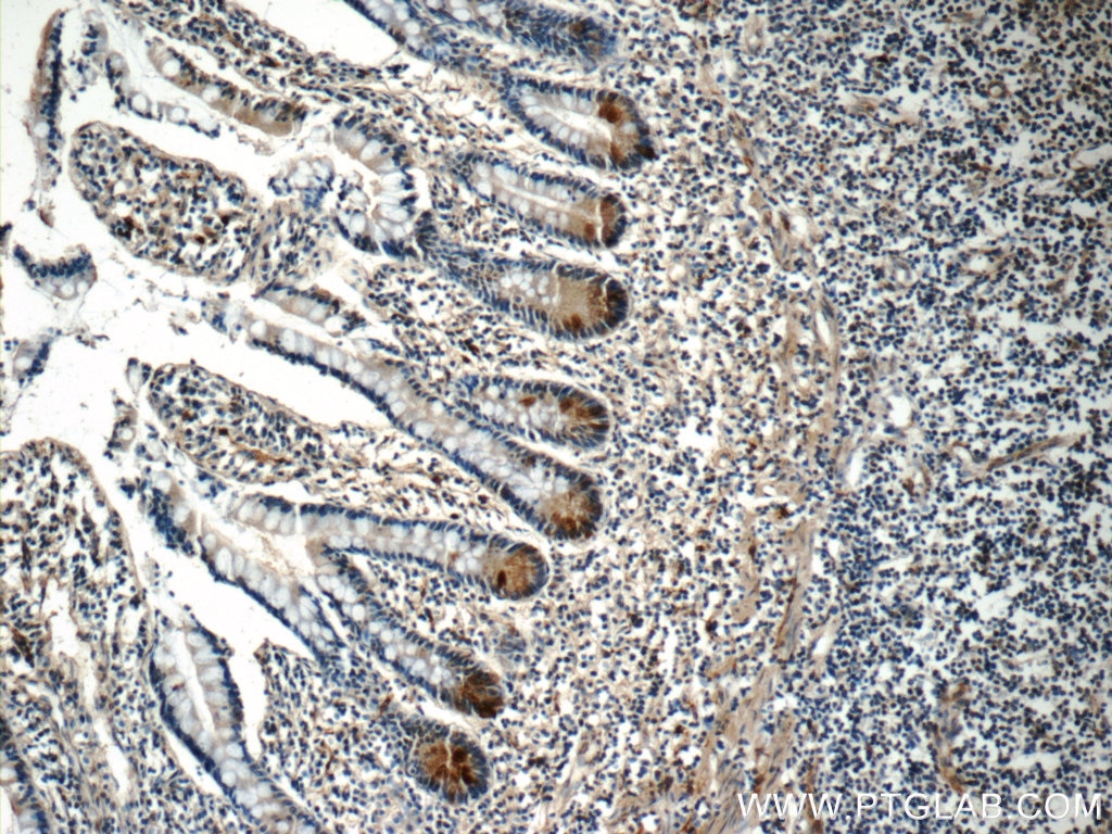 IHC staining of human small intestine using 17180-1-AP