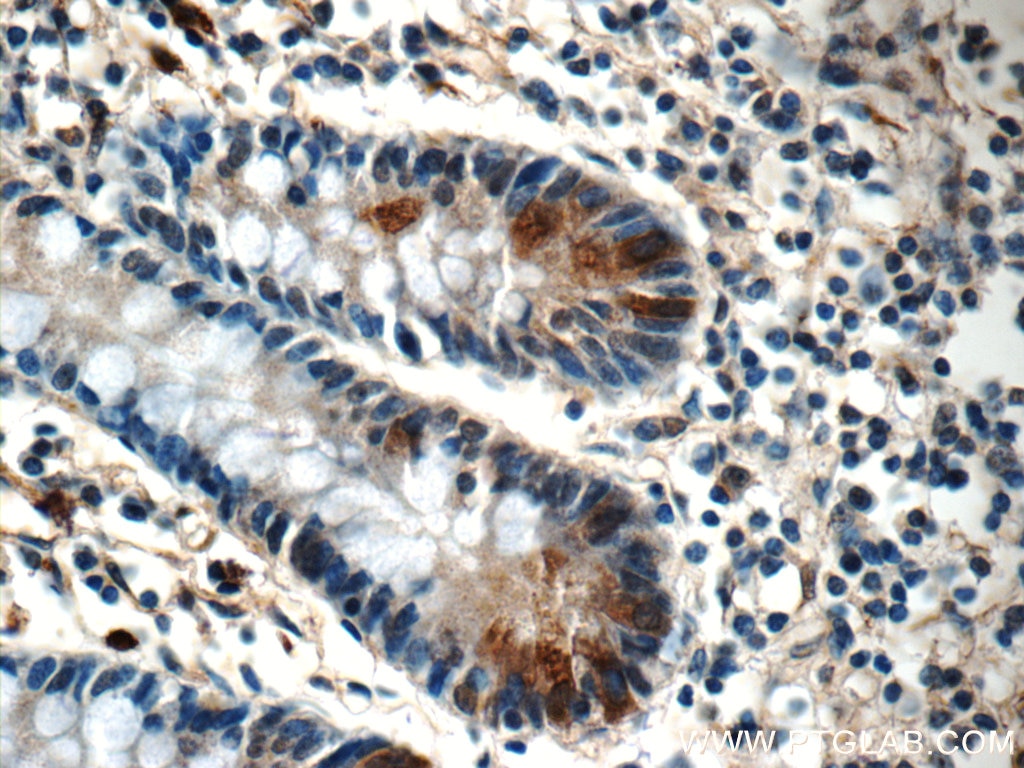 Immunohistochemistry (IHC) staining of human small intestine tissue using LETM2 Polyclonal antibody (17180-1-AP)