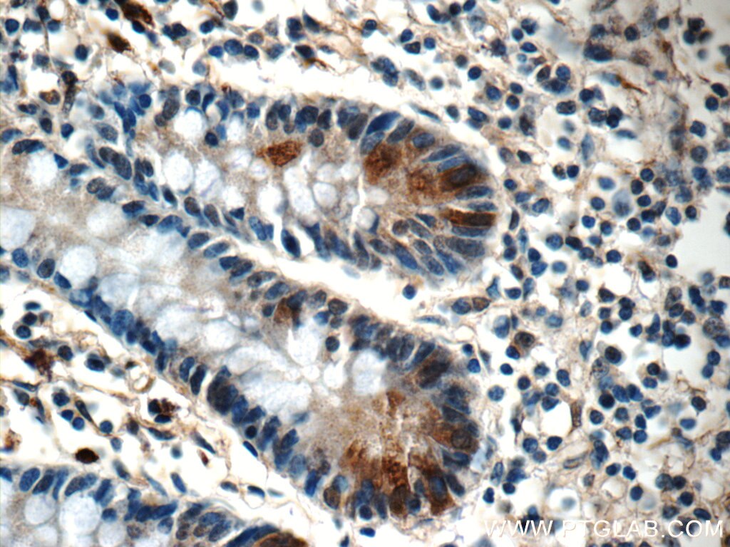 IHC staining of human small intestine using 17180-1-AP