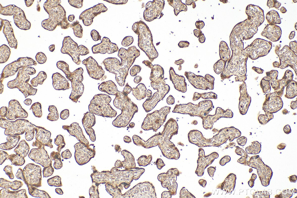 Immunohistochemistry (IHC) staining of human placenta tissue using LGALS13 Polyclonal antibody (17823-1-AP)