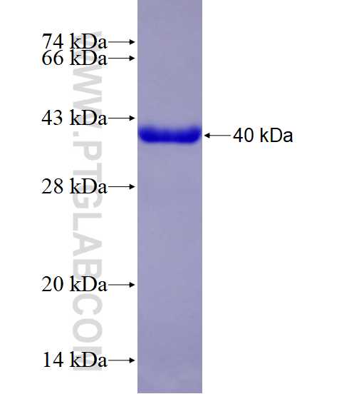 LGALS2 fusion protein Ag3979 SDS-PAGE