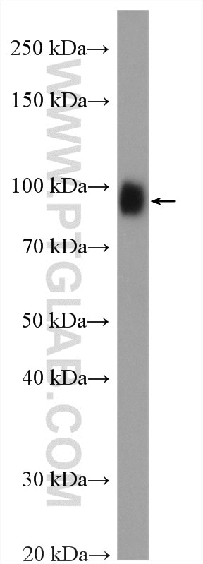 Western Blot (WB) analysis of fetal human brain tissue using LGALS3BP Polyclonal antibody (10281-1-AP)