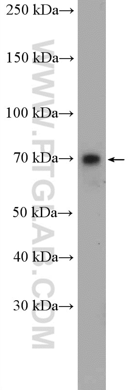 Western Blot (WB) analysis of A549 cells using LGALS3BP Polyclonal antibody (10281-1-AP)