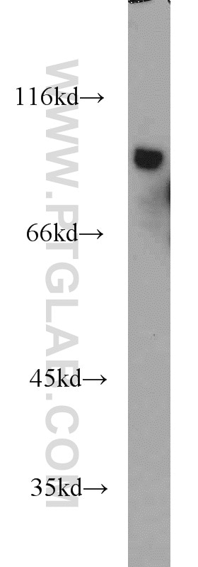 Western Blot (WB) analysis of HeLa cells using LGALS3BP Polyclonal antibody (10281-1-AP)