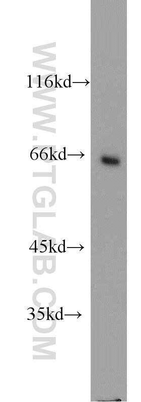 Western Blot (WB) analysis of COLO 320 cells using LGALS3BP Polyclonal antibody (10281-1-AP)