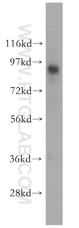 Western Blot (WB) analysis of HEK-293 cells using LGALS3BP Polyclonal antibody (10281-1-AP)