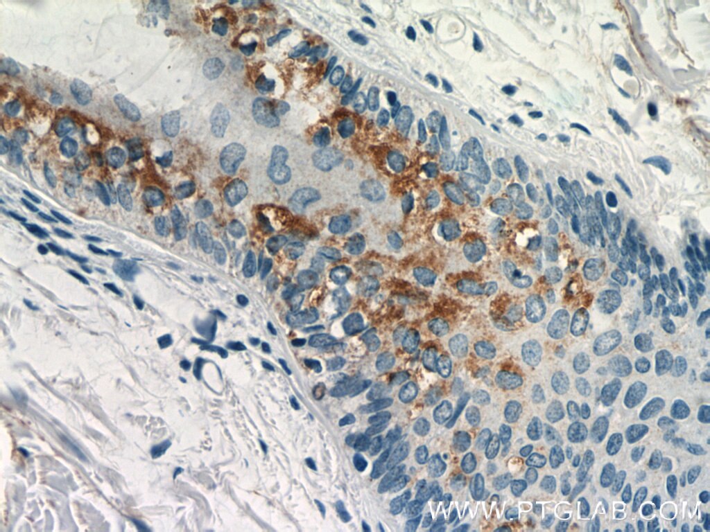 Immunohistochemistry (IHC) staining of human skin tissue using LGALS3BP Polyclonal antibody (23307-1-AP)