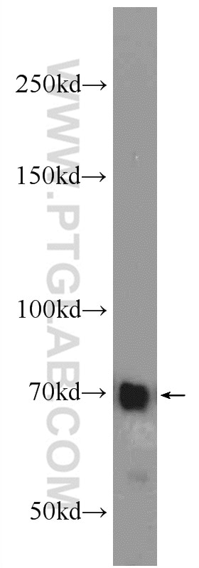 Western Blot (WB) analysis of HepG2 cells using LGALS3BP Polyclonal antibody (23307-1-AP)