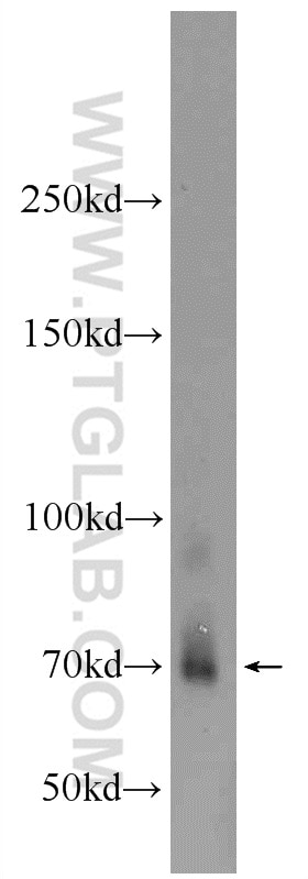 Western Blot (WB) analysis of mouse brain tissue using LGALS3BP Polyclonal antibody (23307-1-AP)