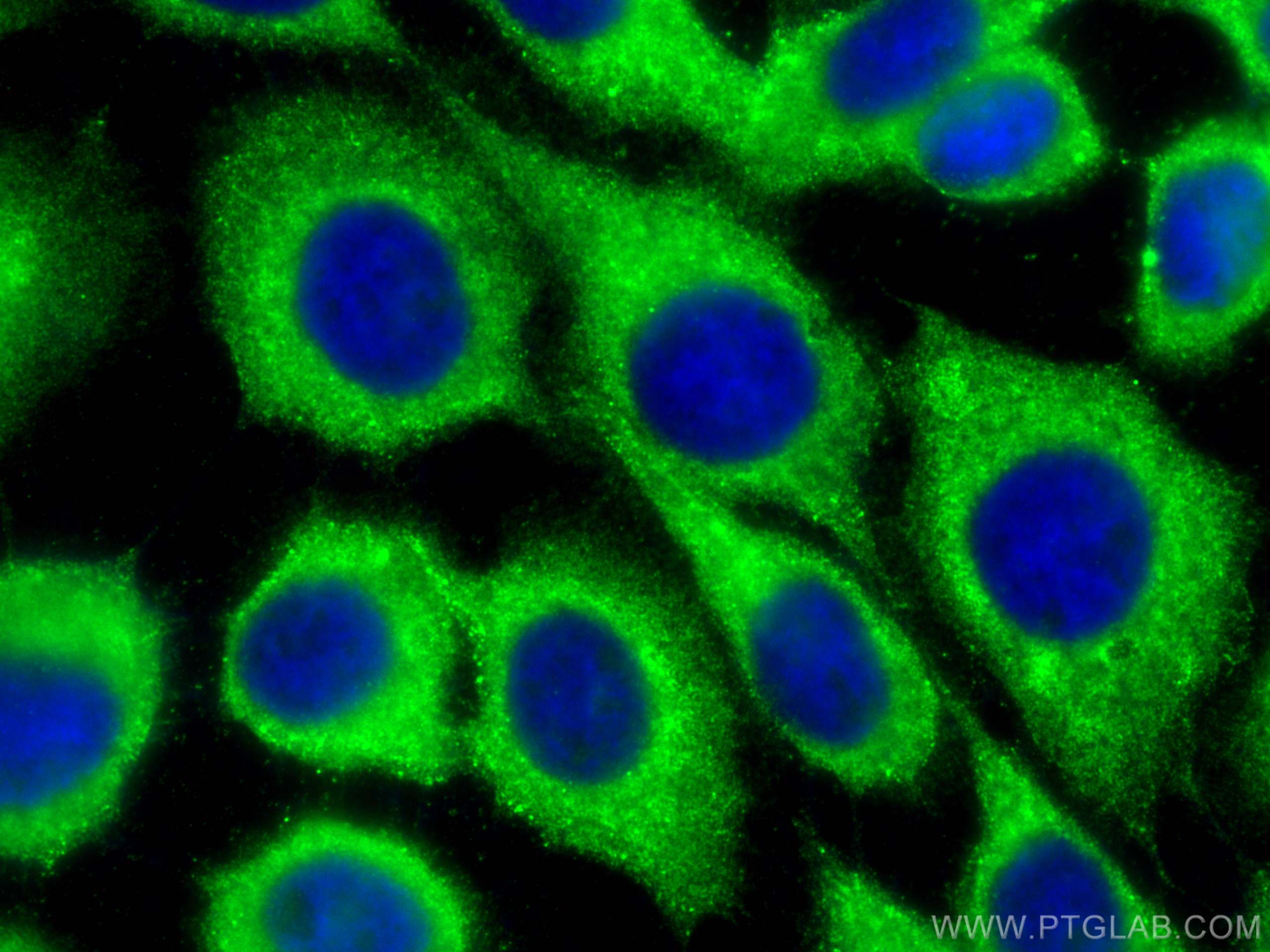 Immunofluorescence (IF) / fluorescent staining of A431 cells using LGALS3BP Monoclonal antibody (60066-1-Ig)