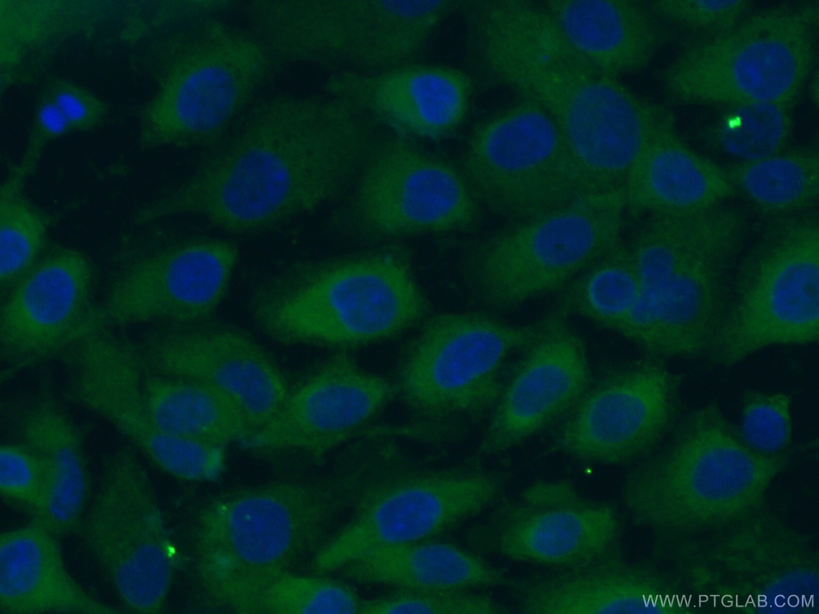 Immunofluorescence (IF) / fluorescent staining of A431 cells using LGALS3BP Monoclonal antibody (60066-1-Ig)