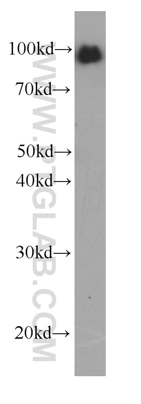 Western Blot (WB) analysis of human blood using LGALS3BP Monoclonal antibody (60066-1-Ig)