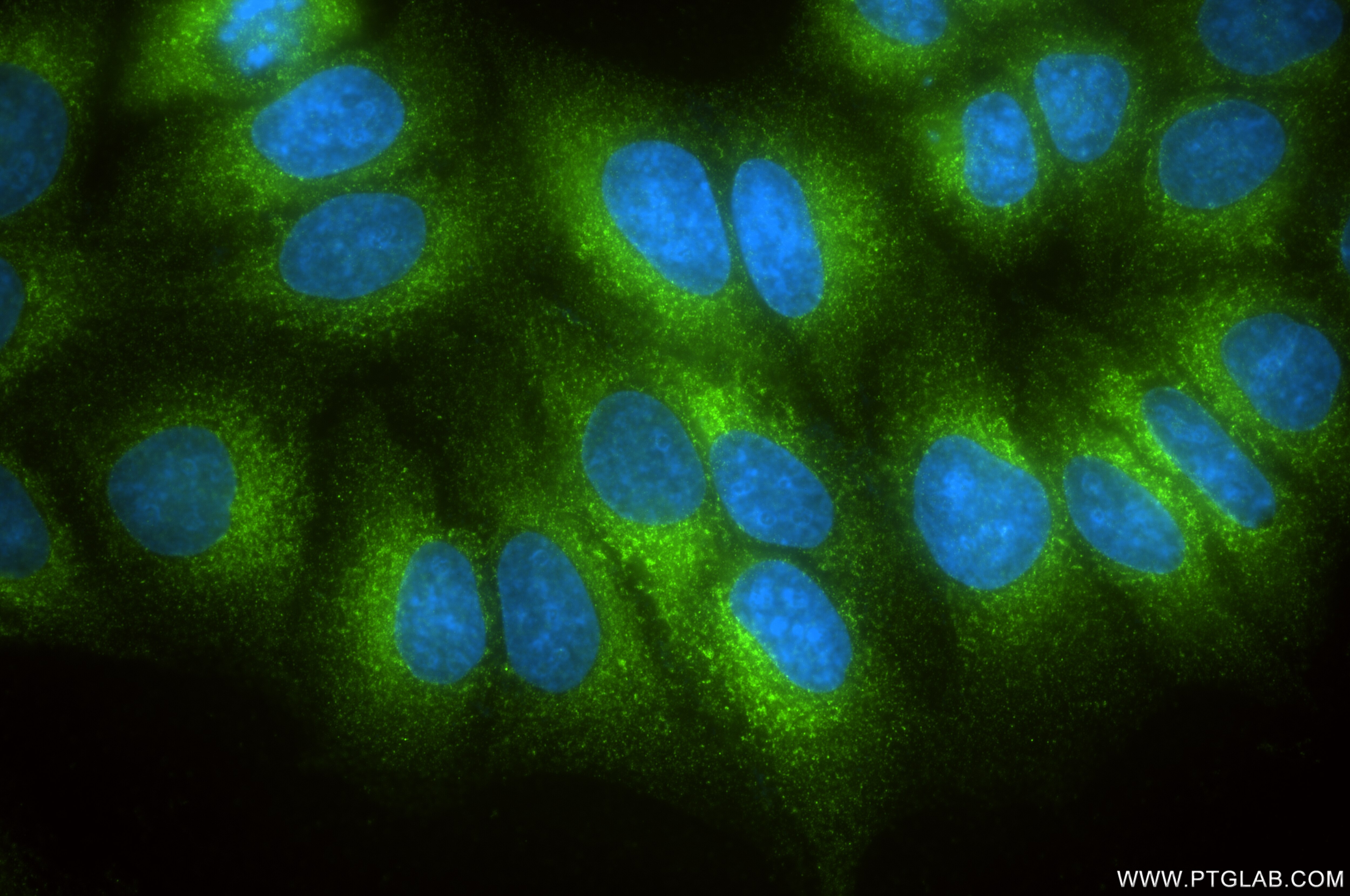 Immunofluorescence (IF) / fluorescent staining of HepG2 cells using LGALS3BP Recombinant antibody (85883-5-RR)
