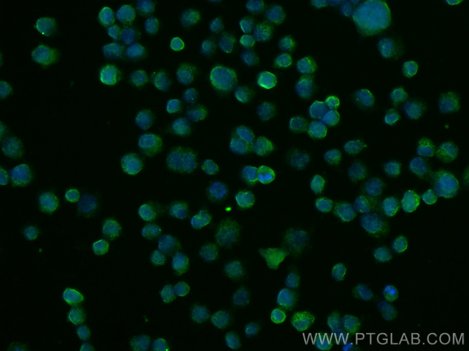 Immunofluorescence (IF) / fluorescent staining of COLO 320 cells using Galectin-4 Polyclonal antibody (13391-1-AP)