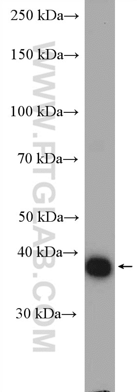 Western Blot (WB) analysis of mouse colon tissue using Galectin-4 Polyclonal antibody (27552-1-AP)