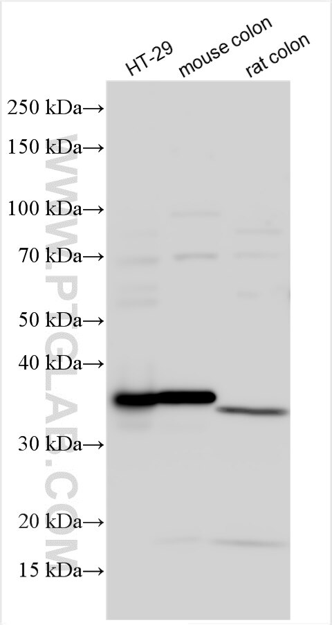 Western Blot (WB) analysis of various lysates using Galectin-4 Polyclonal antibody (27552-1-AP)